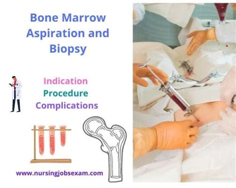 understanding bone marrow biopsy results|complications after bone marrow biopsy.